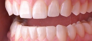 Healthy attractive smile after