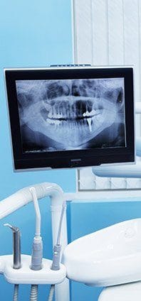X-rays of damaged tooth before extraction