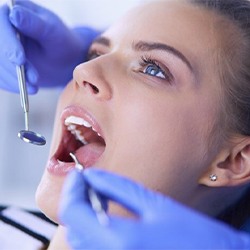 dentist examining a patient’s mouth