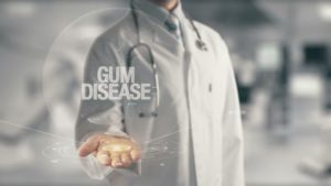 Gum disease graphic